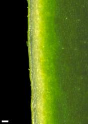 Veronica stricta var. egmontiana. Leaf margin, showing distant very short hairs. Scale = 0.1 mm.
 Image: W.M. Malcolm © Te Papa CC-BY-NC 3.0 NZ